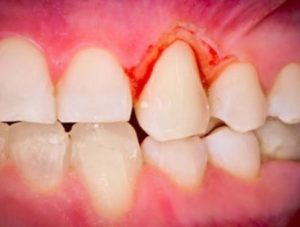Periodontics