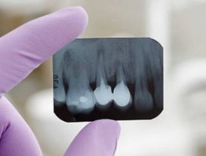XRays
